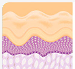 Cross-sectional illustration of skin sagging analysis