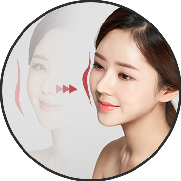 Line — 45-degree lateral cheekbone line (Ogee Curve)