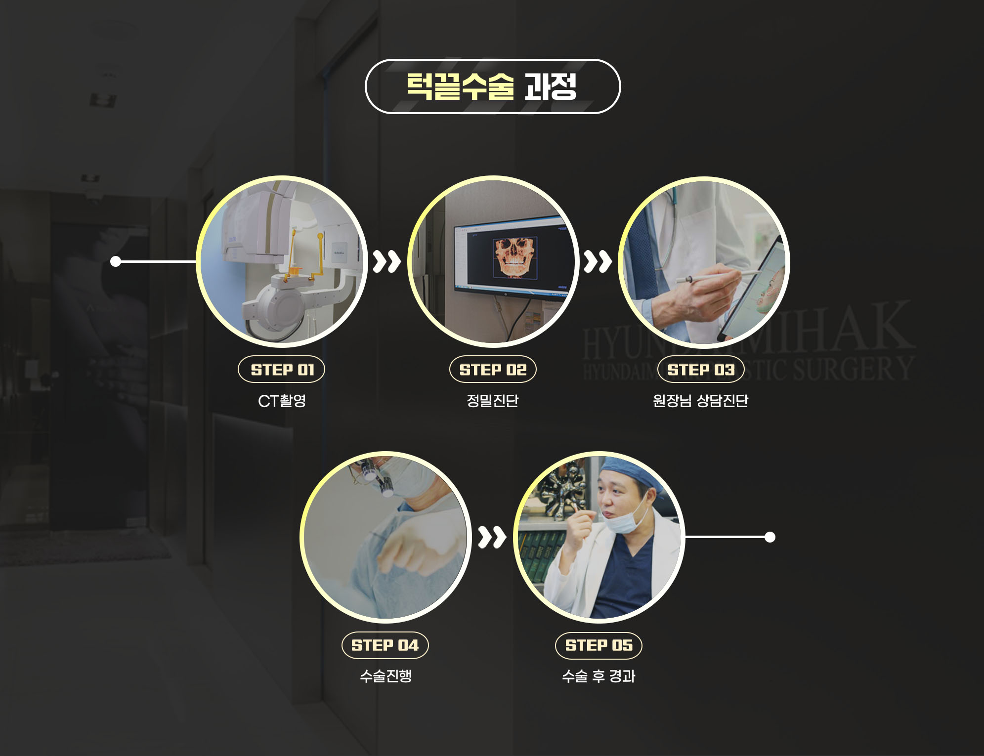 Chin tip surgery process — STEP 01 CT scan, STEP 02 precise diagnosis, STEP 03 consultation and diagnosis with the director, STEP 04 surgery, STEP 05 post-operative follow-up