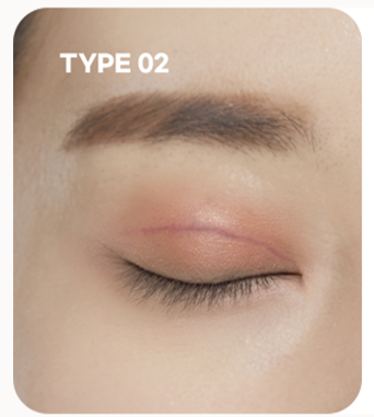 Residual scars after surgery case
