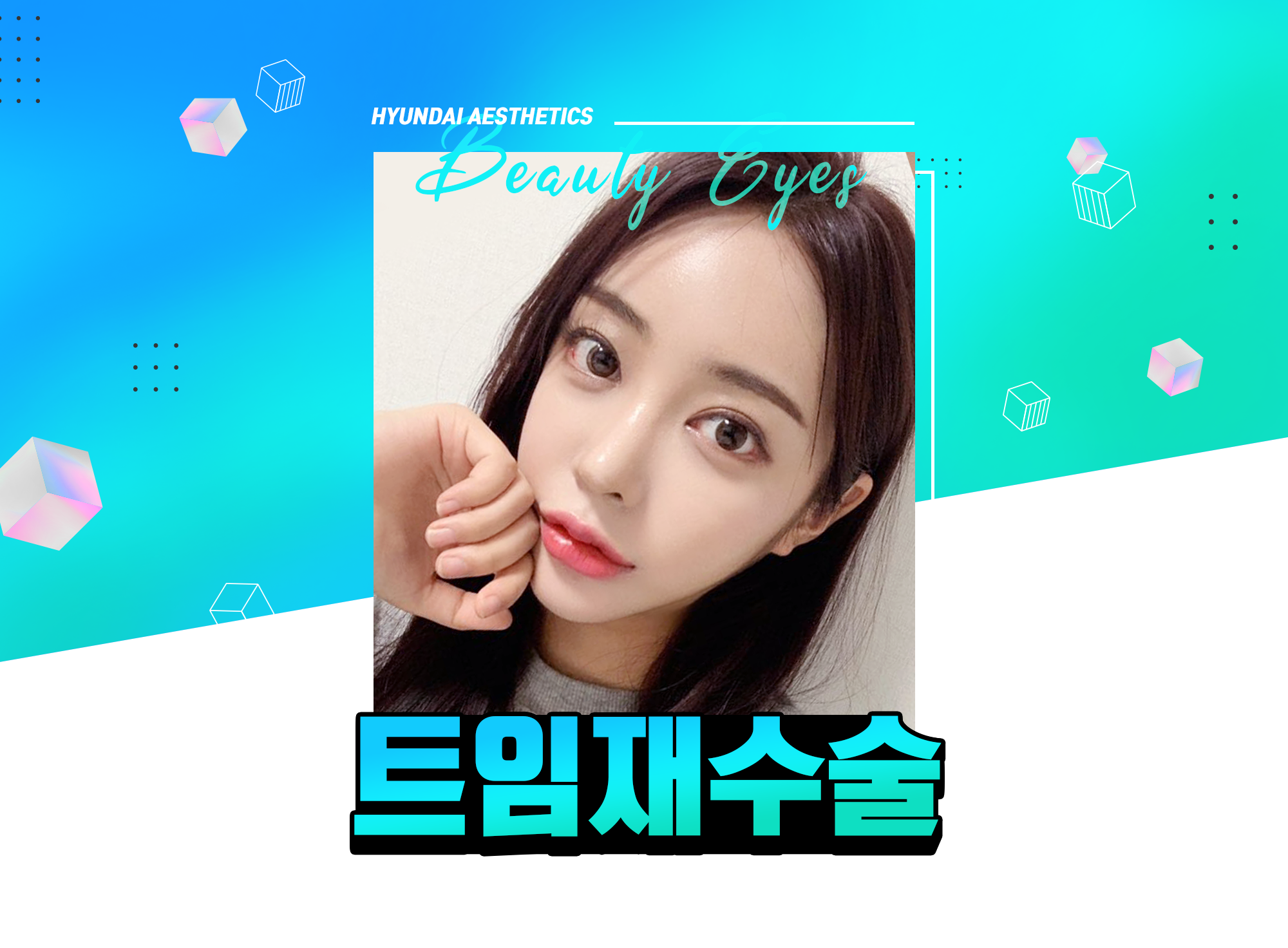 Hyundai Aesthetics Epicanthoplasty Reoperation