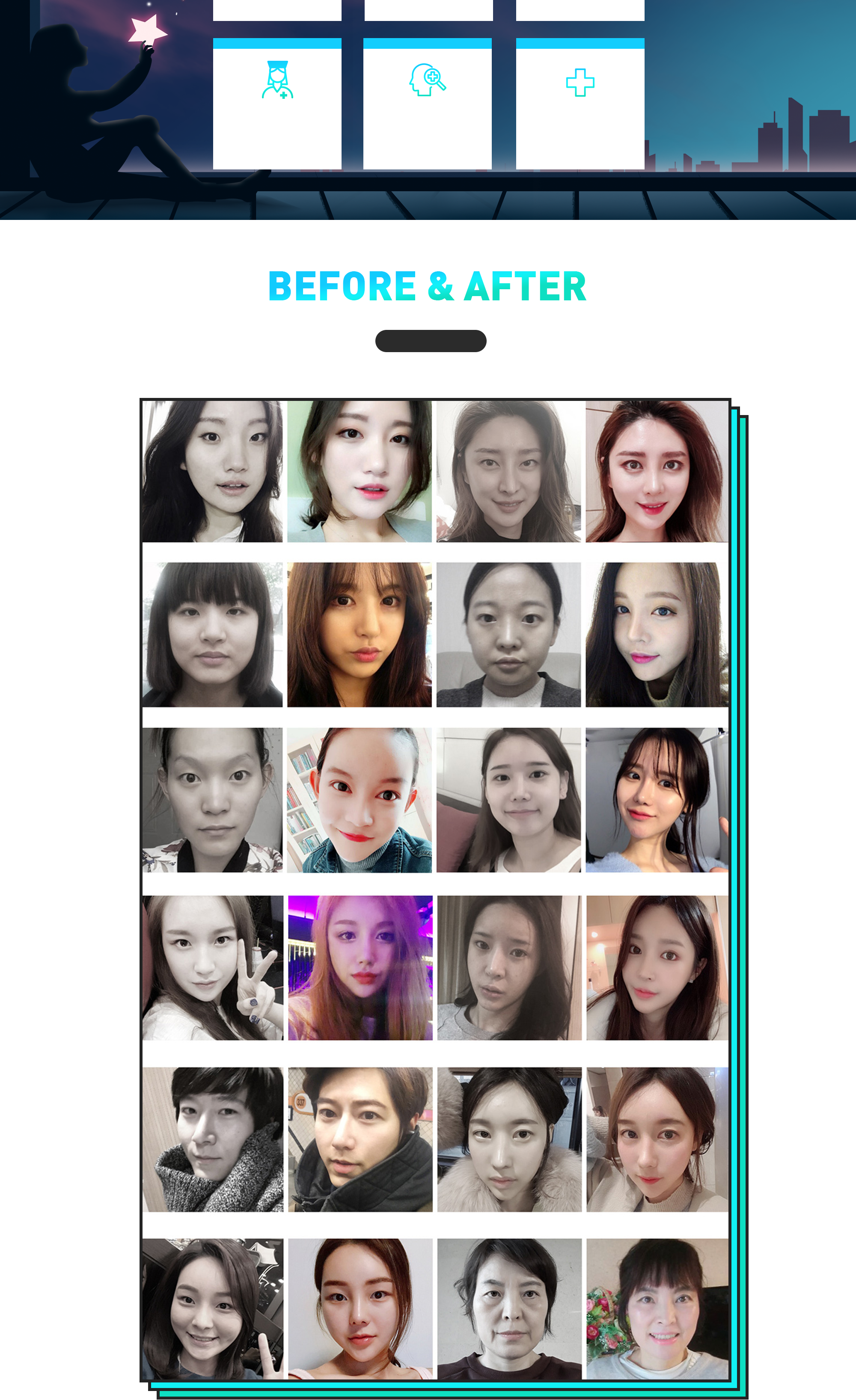 Hyundai Aesthetics epicanthoplasty reoperation care system and BEFORE & AFTER cases
