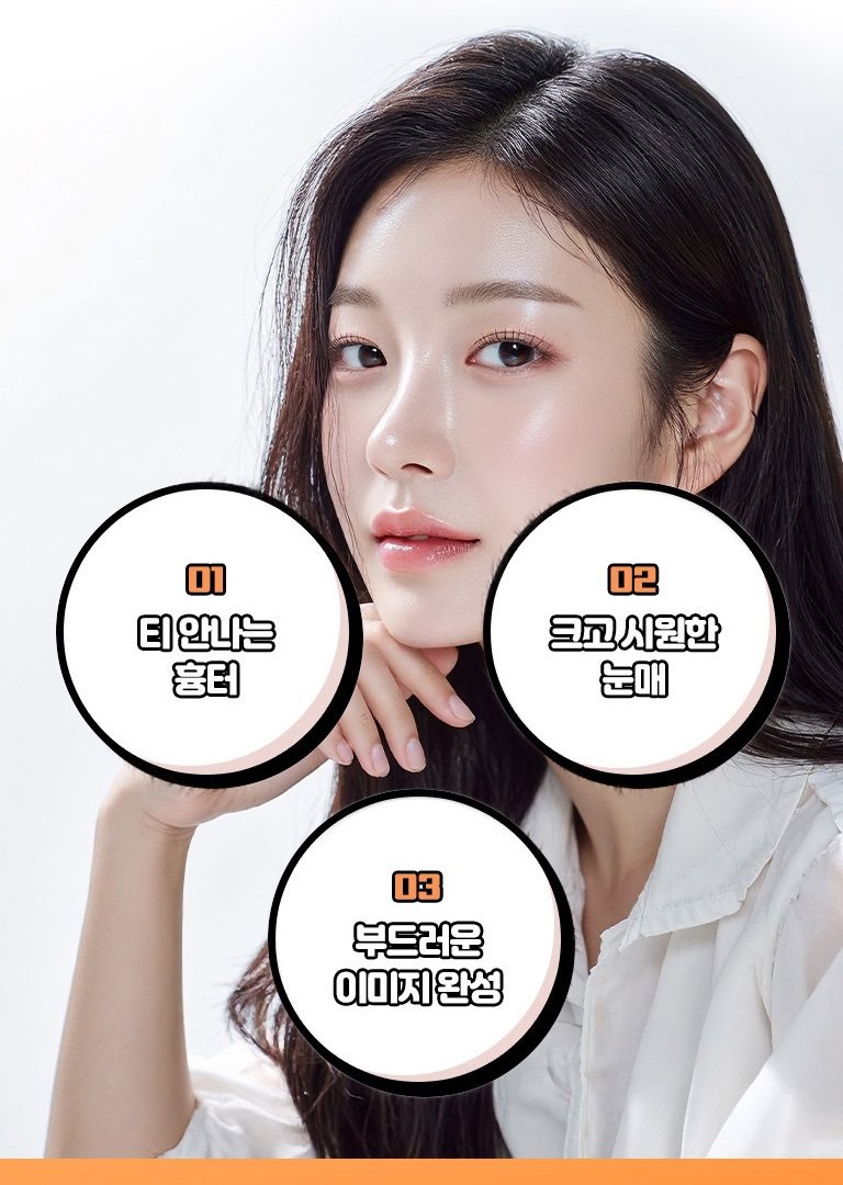 Epicanthoplasty result model — larger, more open-looking eyes