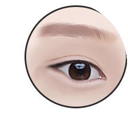 Rear epicanthoplasty step 1 — blocked-looking, upturned eyes