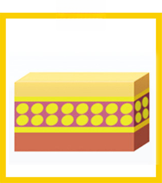 Fat cell removal — cross-section of a refined fat layer