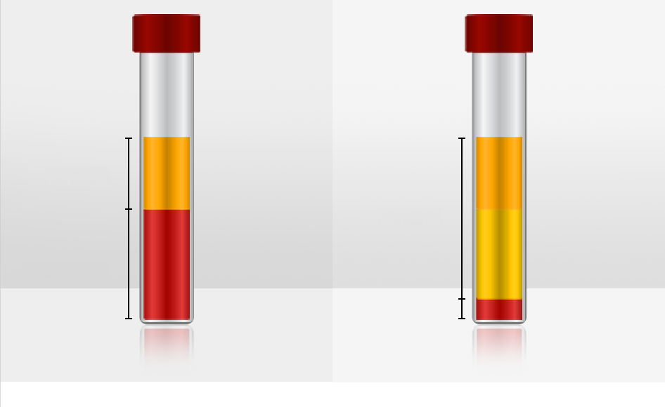 Selectively suctioning only pure fat — comparison of solution and blood