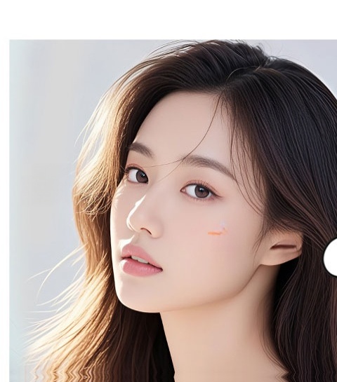Example photo 2 of incision double eyelid surgery results