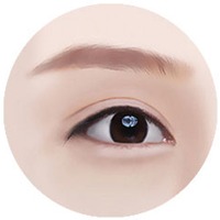 Illustration of STEP 04 finishing stage for incision double eyelid surgery