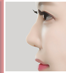 Hump nose side-profile case 2