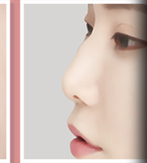 Hump nose side-profile case 3