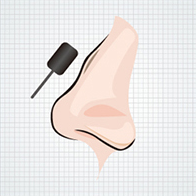 Before mild hump nose correction