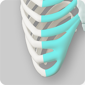 Illustration of autologous rib cartilage