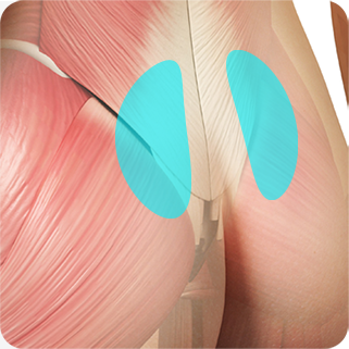 Illustration of autologous dermis