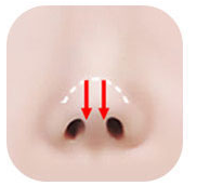 Illustration of a contracted nose