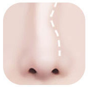 Illustration of a nose with a deviated bridge